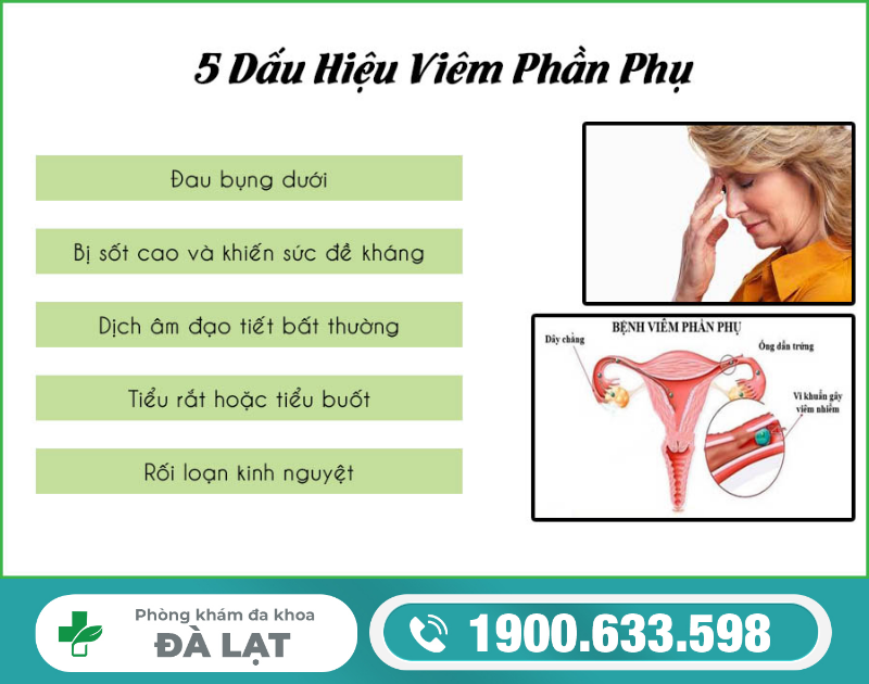 Hình ảnh minh họa